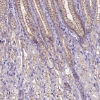 Immunohistochemical staining of human stomach shows moderate membranous positivity in glandular cells.