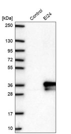 Anti-EI24 Antibody