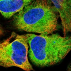 Immunofluorescent staining of human cell line U-2 OS shows localization to cytosol & endoplasmic reticulum.