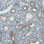 Immunohistochemical staining of human kidney shows membranous positivity in renal tubules.
