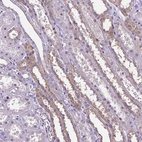 Immunohistochemical staining of human kidney shows moderate membranous positivity in cells in distal tubules.