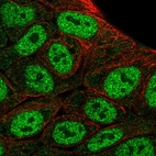 Anti-HOXD1 Antibody