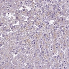 Immunohistochemical staining of human liver shows weak to moderate membranous positivity in hepatocytes.