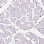 Immunohistochemical staining of human skeletal muscle shows no positivity in myocytes as expected.