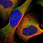 Immunofluorescent staining of human cell line U-2 OS shows localization to cytosol.