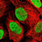 Immunofluorescent staining of human cell line U-2 OS shows localization to nucleoplasm.