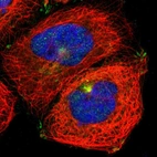 Immunofluorescent staining of human cell line A-431 shows localization to microtubule organizing center & focal adhesion sites.