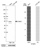 Western blot analysis in human cell lines HeLa and U-251MG using Anti-STXBP2 antibody. Corresponding STXBP2 RNA-seq data are presented for the same cell lines. Loading control: Anti-PPIB.