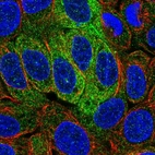 Immunofluorescent staining of human cell line RT4 shows localization to cytosol.