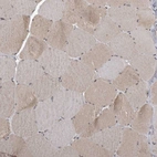 Immunohistochemical staining of human skeletal muscle shows very weak positivity in myocytes as expected.