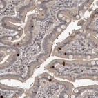 Immunohistochemical staining of human duodenum shows strong cytoplasmic positivity in enteroendocrine cells.