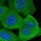 Immunofluorescent staining of human cell line A-431 shows localization to plasma membrane.