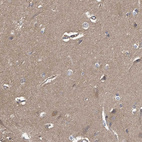 Immunohistochemical staining of human cerebral cortex shows moderate positivity in neuropil.