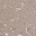 Immunohistochemical staining of human cerebral cortex shows moderate positivity in neuropil.