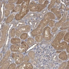 Immunohistochemical staining of human kidney shows strong cytoplasmic positivity in cells in tubules.