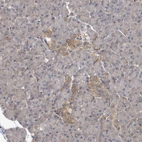 Immunohistochemical staining of human pancreas shows moderate cytoplasmic positivity in islets of Langerhans.