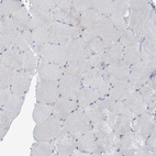 Immunohistochemical staining of human skeletal muscle shows no positivity in myocytes as expected.