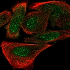 Immunofluorescent staining of human cell line PC-3 shows localization to nucleoplasm.