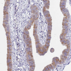 Immunohistochemical staining of human fallopian tube shows moderate cytoplasmic positivity in glandular cells.