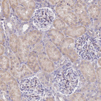 Immunohistochemical staining of human kidney shows moderate cytoplasmic positivity in cells in tubules.