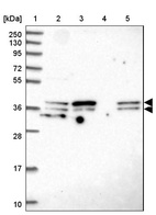 Lane 1: Marker [kDa] 250, 130, 95, 72, 55, 36, 28, 17, 10_br/_Lane 2: Human cell line RT-4_br/_Lane 3: Human cell line U-251 MG_br/_Lane 4: Human plasma_br/_Lane 5: Human Liver tissue