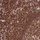 Immunohistochemical staining of human tonsil shows strong cytoplasmic positivity in non-germinal center cells.