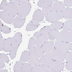 Immunohistochemical staining of human skeletal muscle shows no positivity in myocytes as expected.