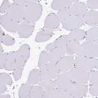 Immunohistochemical staining of human skeletal muscle shows no positivity in myocytes as expected.
