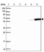 Lane 1: Marker [kDa] 250, 130, 95, 72, 55, 36, 28, 17, 10_br/_Lane 2: Human cell line RT-4_br/_Lane 3: Human cell line U-251MG sp_br/_Lane 4: Human plasma (IgG/HSA depleted)_br/_Lane 5: Human liver tissue_br/_Lane 6: Human tonsil tissue