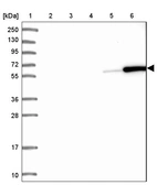 Lane 1: Marker [kDa] 250, 130, 95, 72, 55, 36, 28, 17, 10_br/_Lane 2: Human cell line RT-4_br/_Lane 3: Human cell line U-251MG sp_br/_Lane 4: Human plasma (IgG/HSA depleted)_br/_Lane 5: Human liver tissue_br/_Lane 6: Human tonsil tissue