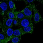 Immunofluorescent staining of human cell line Hep G2 shows localization to cytosol.