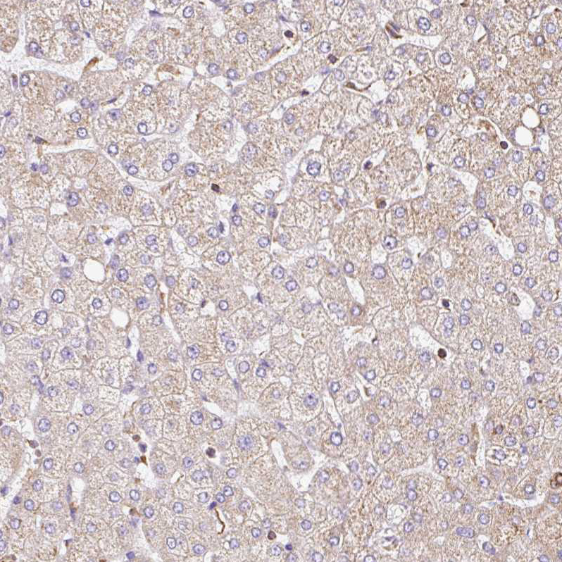 Rabbit Polyclonal Anti-KLHL11 Antibody - Buy for research - Highly ...