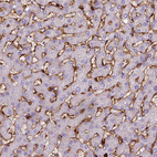 Anti-CD14 Antibody