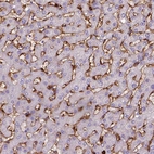 Immunohistochemical staining of human liver shows moderate to strong membranous positivity in Kupffer cells.