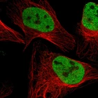 Immunofluorescent staining of human cell line U-2 OS shows localization to nucleoplasm.