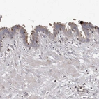 Immunohistochemical staining of human Fallopian tube shows weak to moderate cytoplasmic positivity in glandular cells.