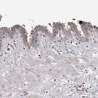 Immunohistochemical staining of human Fallopian tube shows weak to moderate cytoplasmic positivity in glandular cells.