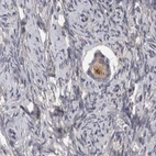 Immunohistochemical staining of human ovary using Anti-PCM1 antibody HPA023374.