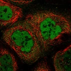 Immunofluorescent staining of human cell line A-431 shows localization to nucleoplasm & cytosol.