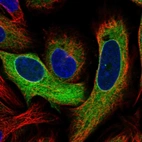 Immunofluorescent staining of human cell line SiHa shows localization to endoplasmic reticulum.
