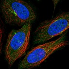Immunofluorescent staining of human cell line SiHa shows localization to the Golgi apparatus.