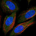 Immunofluorescent staining of human cell line SiHa shows localization to the Golgi apparatus.