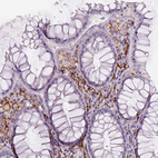 Anti-CD14 Antibody