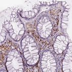 Immunohistochemical staining of human rectum shows moderate to strong membranous positivity in lymphoid cells.
