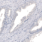 Anti-CNP Antibody