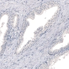 Immunohistochemical staining of human prostate shows no positivity in glandular cells as expected.
