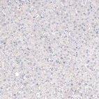 Immunohistochemical staining of human liver shows no positivity in hepatocytes as expected.
