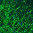 Immunohistochemical staining of rat cerebral cortex shows strong immunoreactivity in oligodendrocytes.