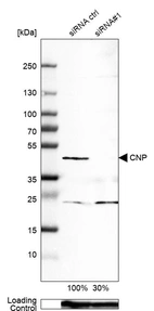 Western blot analysis in A-549 cells transfected with control siRNA, target specific siRNA probe #1, using Anti-CNP antibody. Remaining relative intensity is presented. Loading control: Anti-GAPDH.