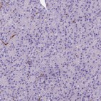 Anti-CD14 Antibody